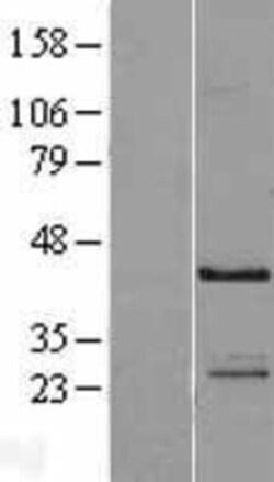 Novus Biologicals&trade;&nbsp;NECAB1 Overexpression Lysate