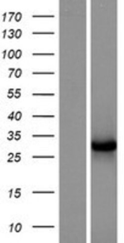 Novus Biologicals&trade;&nbsp;NECAP2 Overexpression Lysate