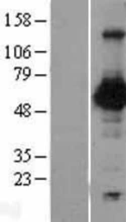 Novus Biologicals&trade;&nbsp;Nectin-2/CD112 Overexpression Lysate