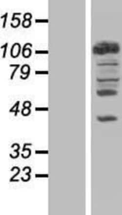 Novus Biologicals™ NEDD4 Overexpression Lysate