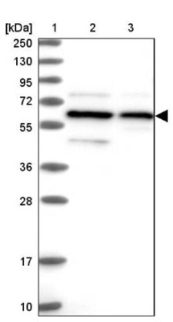 APPBP1 Antibody, Novus Biologicals 25 &mu;L, Unconjugated:Antibodies, Polyclonal