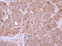 NEDP1/SENP8 Antibody, Novus Biologicals 0.1mL; Unlabeled:Antibodies, Polyclonal