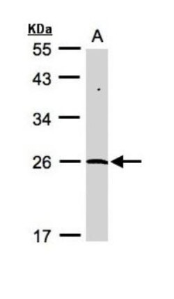 NEDP1/SENP8 Antibody, Novus Biologicals 0.1mL; Unlabeled:Antibodies, Polyclonal