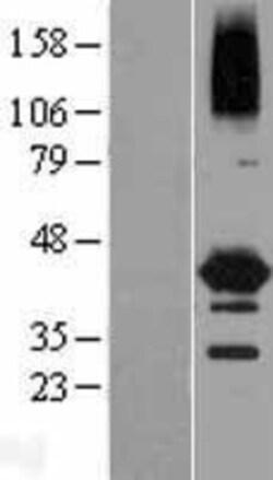 Novus Biologicals&trade;&nbsp;NEIL2 Overexpression Lysate