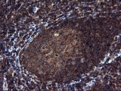 NEK11 Antibody (OTI5D9), Novus Biologicals 0.1mL; Unlabeled:Antibodies,