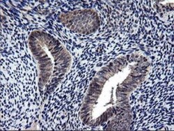 NEK11 Antibody (OTI5D9), Novus Biologicals 0.1mL; Unlabeled:Antibodies,
