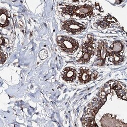 NEK1 Antibody, Novus Biologicals 0.1mL; Unlabeled:Antibodies, Polyclonal