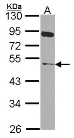 NEK2 Antibody, Novus Biologicals 0.1mL; Unlabeled:Antibodies, Polyclonal