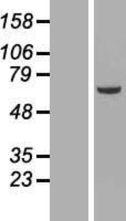 Novus Biologicals&trade;&nbsp;NEK3 Overexpression Lysate