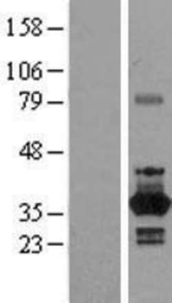 Novus Biologicals&trade;&nbsp;NEK6 Overexpression Lysate