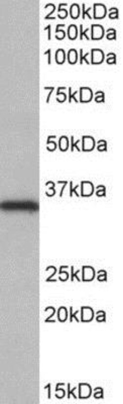 NEK7 Antibody, Novus Biologicals 0.1 mg | Buy Online | Novus Biologicals | Fisher Scientific