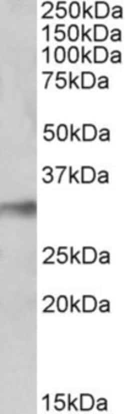 NEK7 Antibody, Novus Biologicals 0.1mg; Unlabeled:Antibodies, Polyclonal