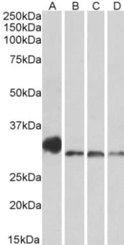 NEK7 Antibody, Novus Biologicals 0.1mg; Unlabeled:Antibodies, Polyclonal