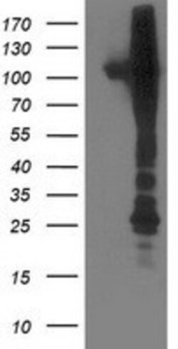 NEK9 Antibody (OTI1H1), Novus Biologicals 0.1mL; Unlabeled:Antibodies,