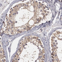 NEK9 Antibody, Novus Biologicals 25 &mu;L; Unlabeled:Antibodies, Polyclonal