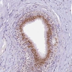 NELL1 Antibody, Novus Biologicals 0.1mL; Unlabeled:Antibodies, Polyclonal