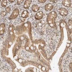 Neogenin Antibody, Novus Biologicals:Antibodies:Primary Antibodies