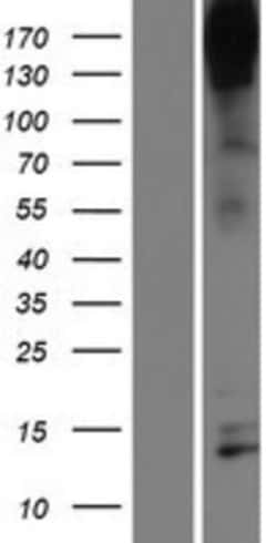 Novus Biologicals&trade;&nbsp;Nephrin Overexpression Lysate