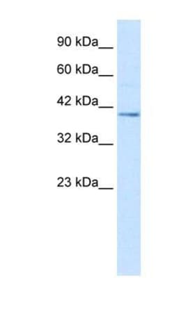 Nesfatin-1/Nucleobindin-2 Antibody, Novus Biologicals:Antibodies:Primary