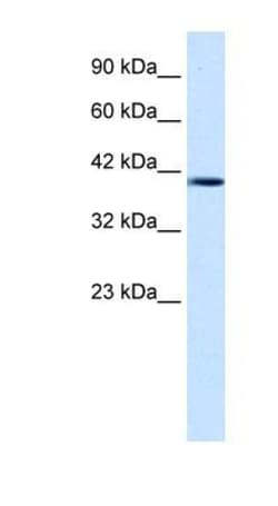 Nesfatin-1/Nucleobindin-2 Antibody, Novus Biologicals 0.1mg; Unlabeled:Antibodies,