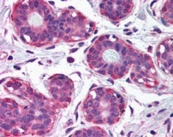 NET1 Antibody, Novus Biologicals 0.1mg; Unlabeled:Antibodies, Polyclonal