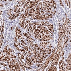NET1 Antibody, Novus Biologicals 0.1mL; Unlabeled:Antibodies, Polyclonal