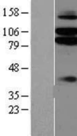 Novus Biologicals&trade;&nbsp;NGL-1/LRRC4C Overexpression Lysate
