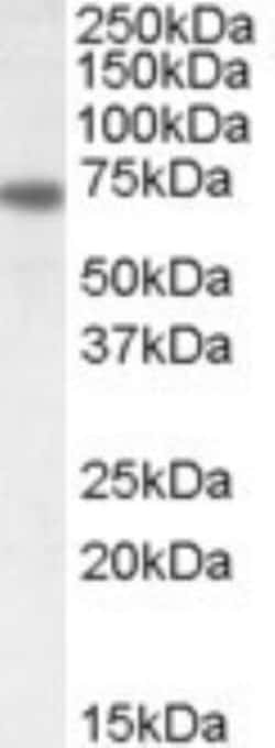 Netrin-1 Antibody, Novus Biologicals 0.1mg; Unlabeled:Antibodies, Polyclonal