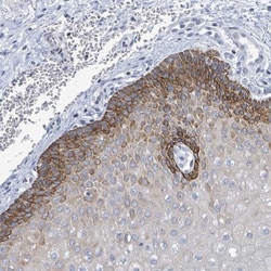 Netrin-2 Antibody, Novus Biologicals:Antibodies:Primary Antibodies