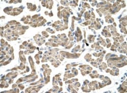 NEU-1/Sialidase-1 Antibody, Novus Biologicals 0.1mg; Unlabeled:Antibodies,