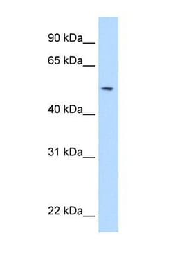 NEU-1/Sialidase-1 Antibody, Novus Biologicals 0.1mg; Unlabeled:Antibodies,