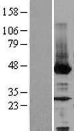 Novus Biologicals&trade;&nbsp;NEU2 Overexpression Lysate