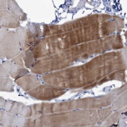 NEU3 Antibody, Novus Biologicals 25 &mu;L | Buy Online | Novus Biologicals | Fisher Scientific