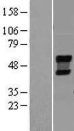 Novus Biologicals&trade;&nbsp;NEU4 Overexpression Lysate