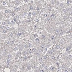 NEU4 Antibody, Novus Biologicals:Antibodies:Primary Antibodies