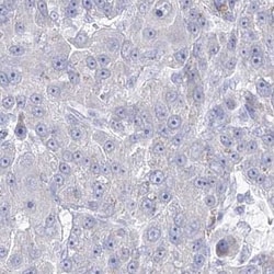 NEU4 Antibody, Novus Biologicals:Antibodies:Primary Antibodies