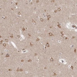 Neudesin Antibody, Novus Biologicals 0.1mL; Unlabeled:Antibodies, Polyclonal