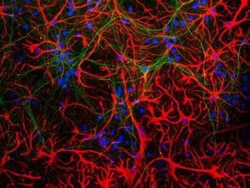 Novus Biologicals Neural Stem Cell Marker Antibody Pack 5 vials:Antibodies