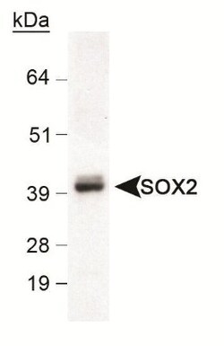 Novus Biologicals Neural Stem Cell Marker Antibody Pack 5 vials:Antibodies
