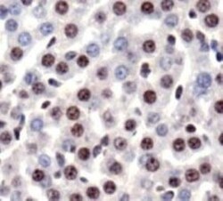 Novus Biologicals Neural Stem Cell Marker Antibody Pack 5 vials:Antibodies