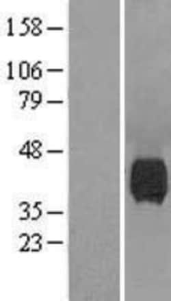 Novus Biologicals&trade;&nbsp;NEU-1/Sialidase-1 Overexpression Lysate