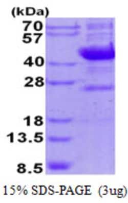 Novus Biologicals&trade;&nbsp;Recombinant Human NEU-1/Sialidase-1 His Protein
