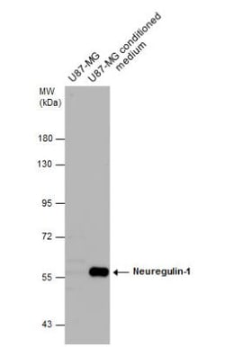 Neuregulin-1/NRG1 Antibody, Novus Biologicals 0.1mL; Unlabeled:Antibodies,