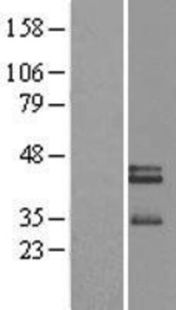 Novus Biologicals™ Neurexophilin-3 Overexpression Lysate