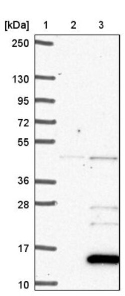 NRN1L Antibody, Novus Biologicals 0.1mL; Unlabeled:Antibodies, Polyclonal