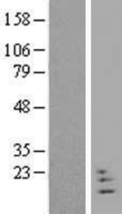 Novus Biologicals&trade;&nbsp;NRN1L Overexpression Lysate