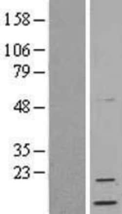 Novus Biologicals™ Neuritin Overexpression Lysate