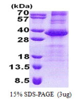 Novus Biologicals&trade;&nbsp;Recombinant Human NEURL2 His Protein