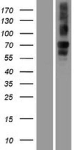 Novus Biologicals&trade;&nbsp;Neurobeachin Overexpression Lysate