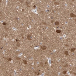 Neurochondrin Antibody, Novus Biologicals 0.1mL; Unlabeled:Antibodies,